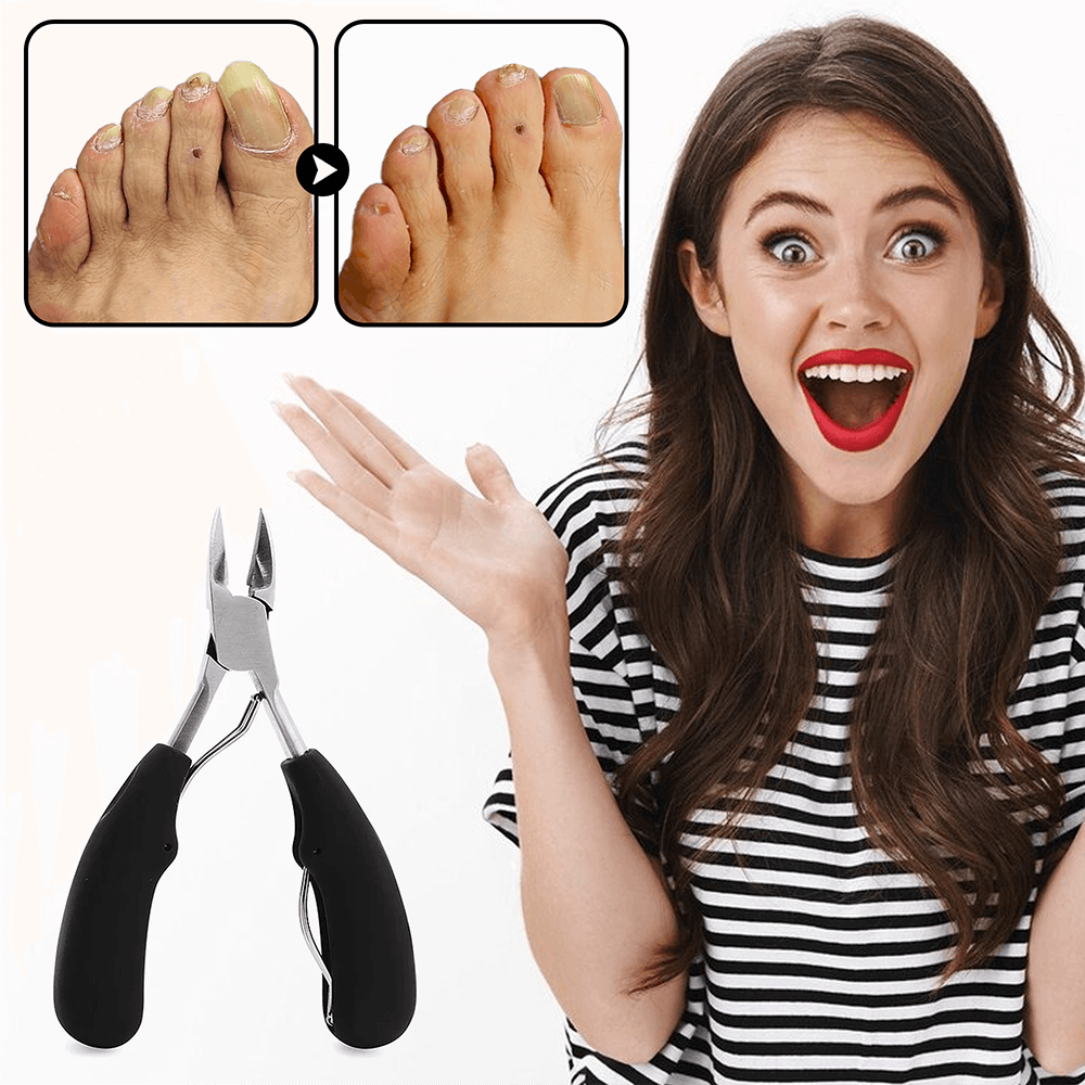 ClipEase® Turns clipping toenails into a simple task!