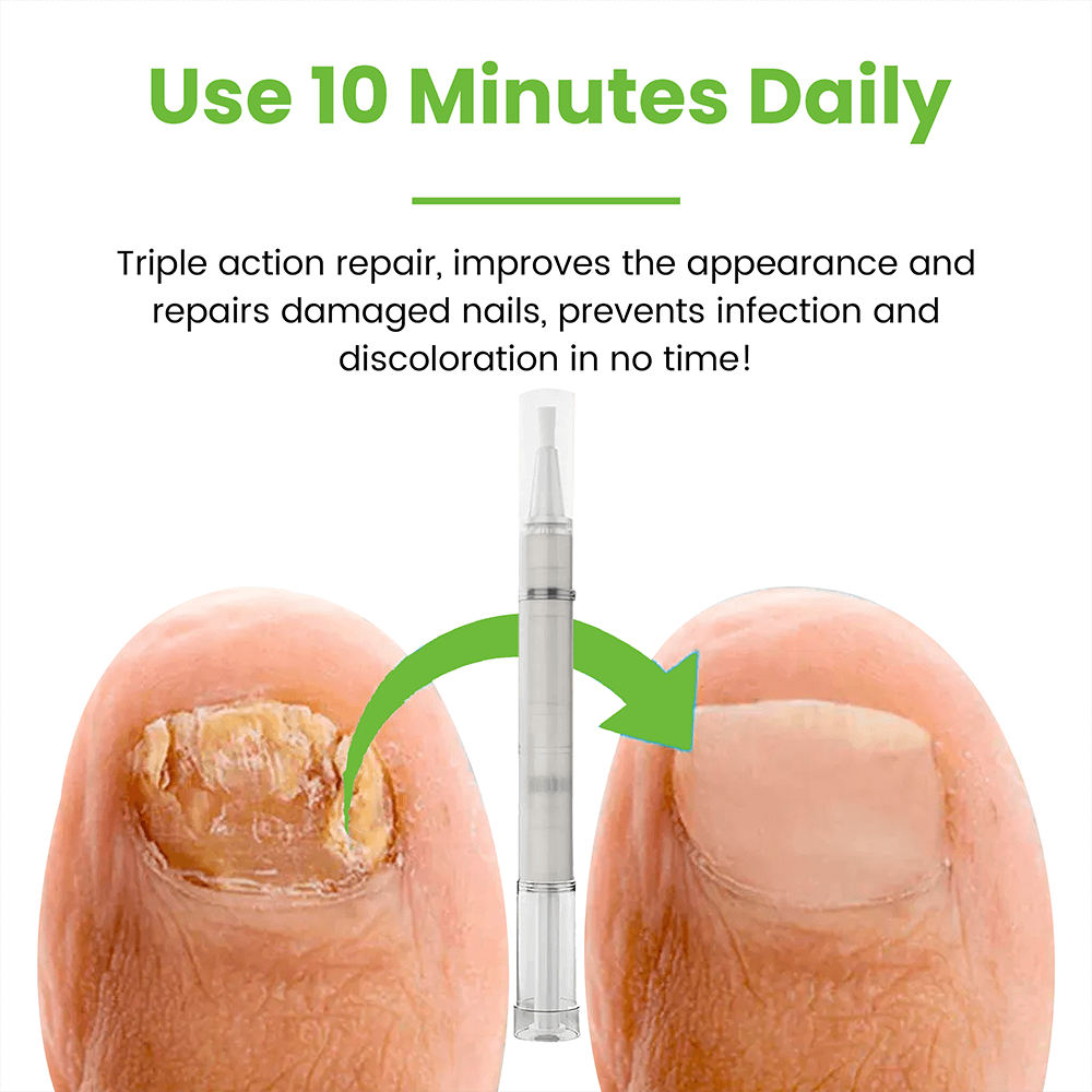 FungiSolve® | Naturally kills toenail fungus and bacteria!