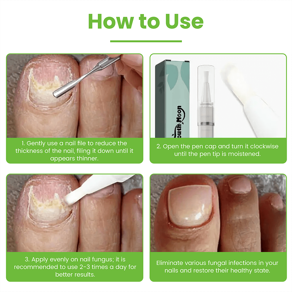 FungiSolve® | Naturally kills toenail fungus and bacteria!